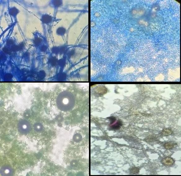 Microscopic observation of different keratolytic fungi.